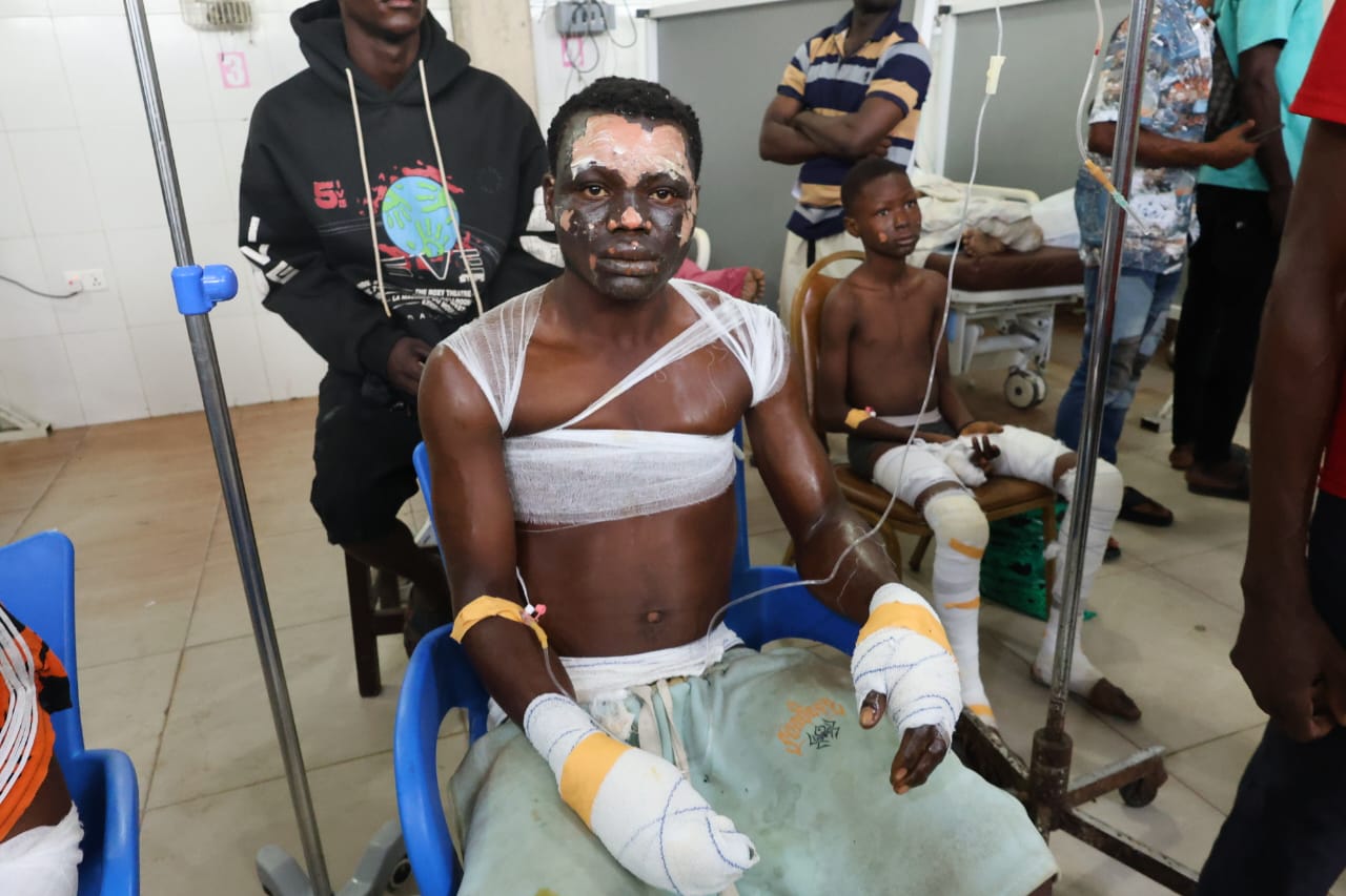 3 Dead, 20 Injured, Seven Vehicles Burnt In Nsawam Fuel Siphoning Tragedy — Police Confirm